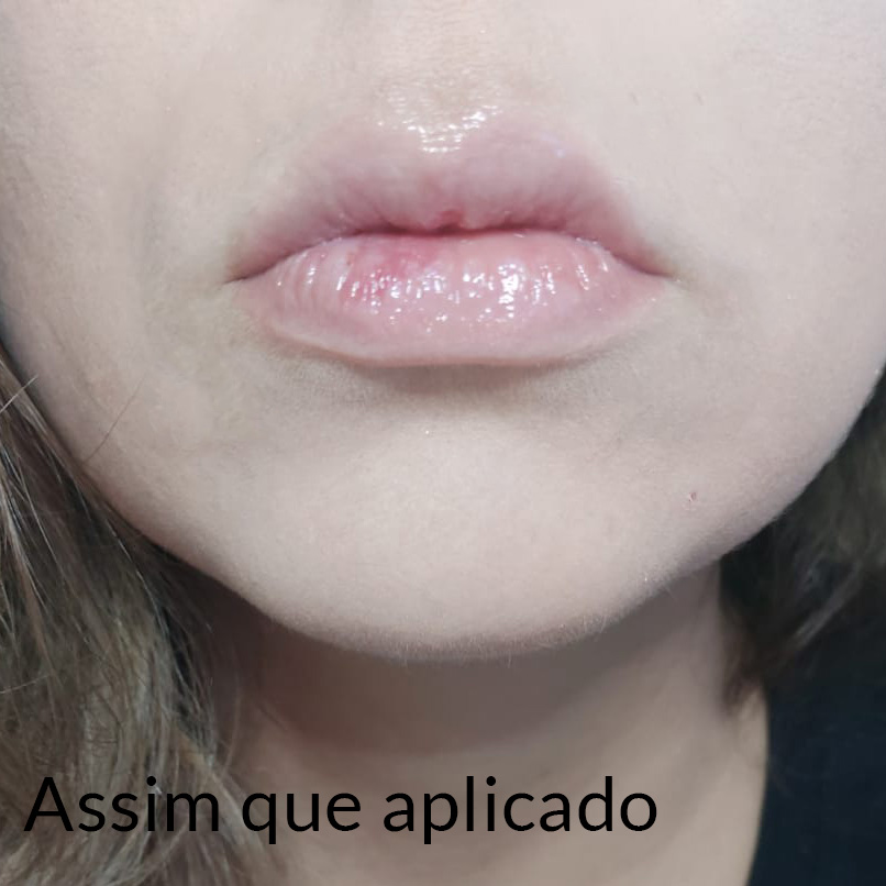 testando_lip_injection_too_faced